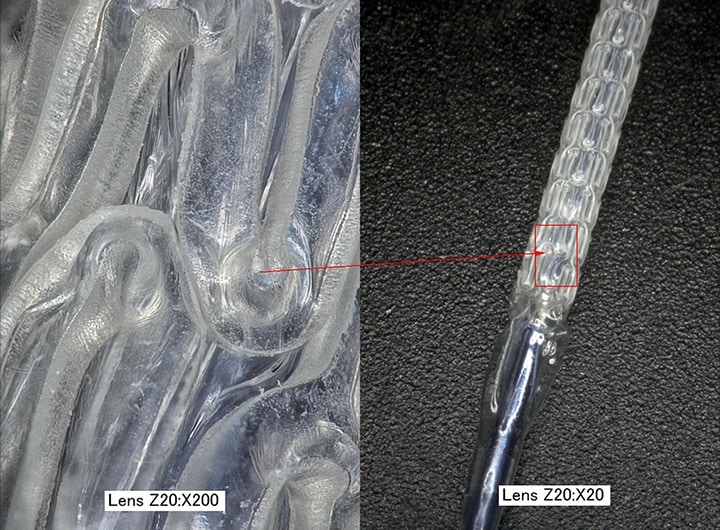 生物可吸收支架的放大影像（左：200×/右：20×）